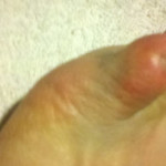 I hurt it - i healed it - toev2